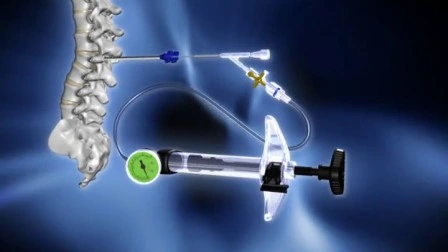低侵襲脊椎手術用ドラゴンクラウン医療整形外科器具